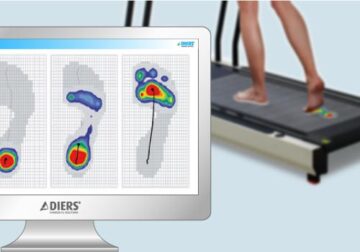 فحص اعوجاج العمود الفقري باستخدام تحليل ضغط القدم: طريقة سهلة وحديثة