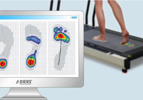 فحص اعوجاج العمود الفقري باستخدام تحليل ضغط القدم: طريقة سهلة وحديثة