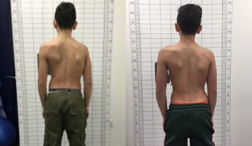 كيفيه الاستعداد لفحص العمود الفقري في المنزل بطريقة صحيحة