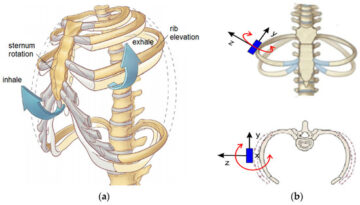 اعوجاج العمود الفقري: كيف يؤثر على حركة القفص الصدري ووظائف الرئة