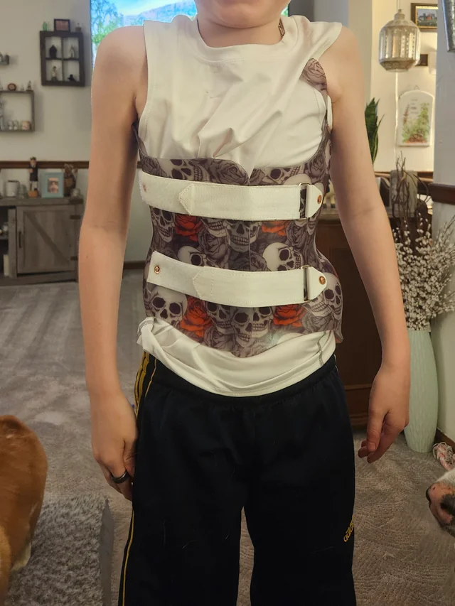 حزام اعوجاج العمود الفقري للأطفال: مخاوف الأمهات وكيفية التعامل بذكاء