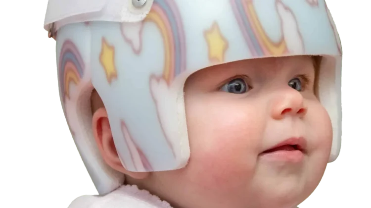 لماذا سعر خوذة علاج الرأس المسطح مرتفع؟ اليك الأسباب وهل تستحق التكلفه