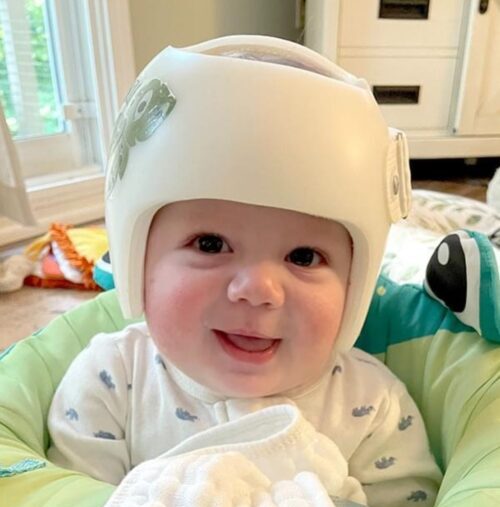 خوذة تصحيح شكل الرأس للرضع: خرافات شائعة يجب أن يتوقف الأهل عن تصديقها