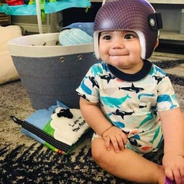 خوذة تعديل شكل الرأس عند الرضع: كيف تعمل ومتى يبدأ طفلك العلاج لتحقيق أفضل النتائج؟