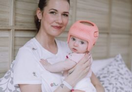 كيف تحصل على خوذة تصحيح شكل الرأس لطفلك؟ خطوات سهلة وموثوقة للأهل