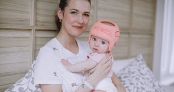 كيف تحصل على خوذة تصحيح شكل الرأس لطفلك؟ خطوات سهلة وموثوقة للأهل