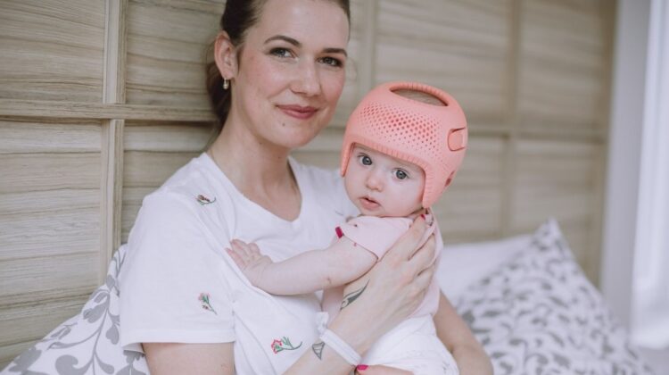 كيف تحصل على خوذة تصحيح شكل الرأس لطفلك؟ خطوات سهلة وموثوقة للأهل