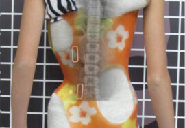 استخدام حزام اعوجاج العمود الفقري الجديد دليل شامل للأهل