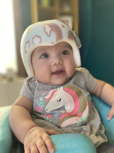 الخوذة الطبية لعلاج تسطح الرأس