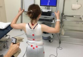 كيف أحصل على حزام اعوجاج العمود الفقري لطفلي؟ الخطوات الصحيحة