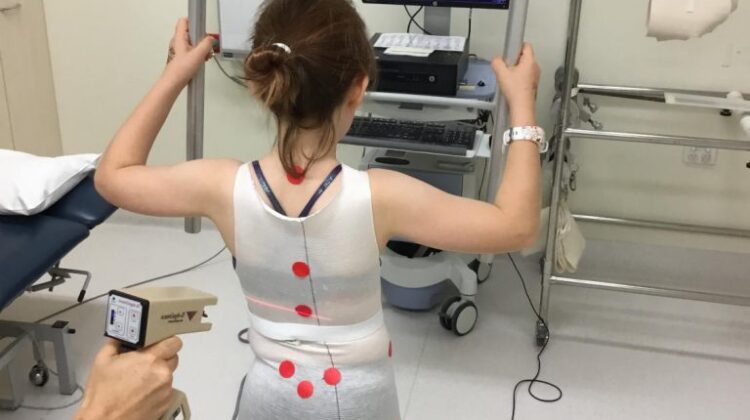 كيف أحصل على حزام اعوجاج العمود الفقري لطفلي؟ الخطوات الصحيحة