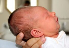 مضاعفات تشوّه شكل الرأس عند الأطفال : دليل المخاطر والوقاية المبكرة