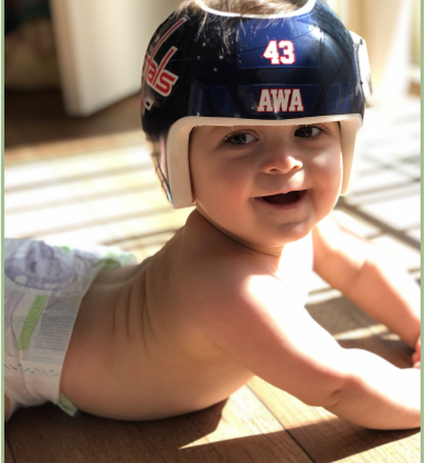 عوامل تزيد مدة العلاج بخوذة تصحيح شكل الرأس عند الرضع: كيف ولماذا قد يطول العلاج؟