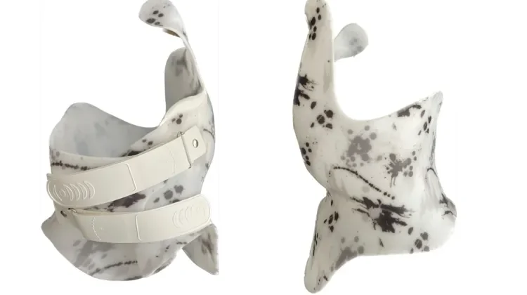 حزام اعوجاج العمود الفقري بعد اكتمال النمو: لماذا لا يفيد وما البدائل؟