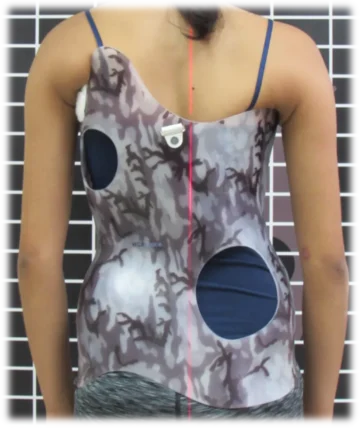 هل يحتاج طفلك لحزام اعوجاج العمود الفقري المخصص؟ إليك كل ما يجب معرفته