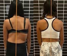 الأخطاء الشائعة عند علاج اعوجاج العمود الفقري وكيفية تجنبها لضمان أفضل النتائج لطفلك