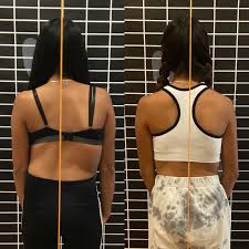 الأخطاء الشائعة عند علاج اعوجاج العمود الفقري وكيفية تجنبها لضمان أفضل النتائج لطفلك