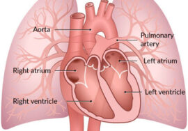 هل اعوجاج العمود الفقري يؤثر على القلب عند الأطفال؟ اكتشف المخاطر والعلاج