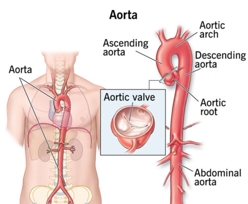ما هو الشريان الأورطي وما علاقته باعوجاج العمود الفقري؟