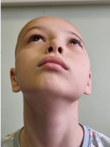 هل يتحسن تسطح الرأس تلقائيًا؟