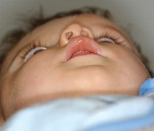 متى تصبح خوذة تسطح الرأس ضرورية؟