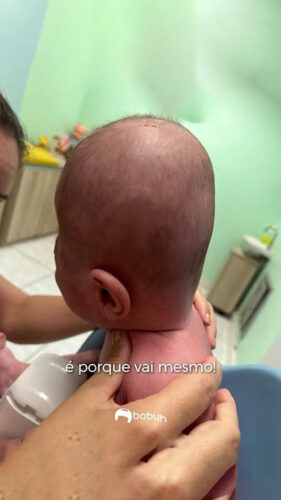 تغير شكل الرأس