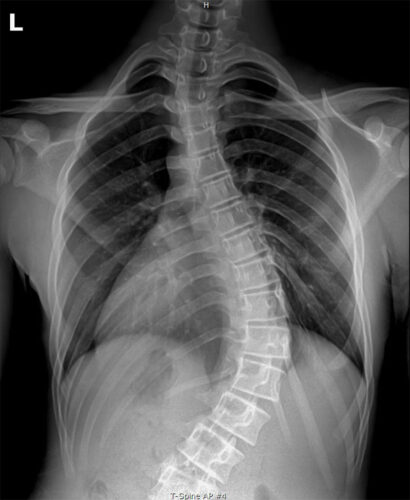 ما علاقة شد الأعصاب بوضعية الجسم اليومية؟