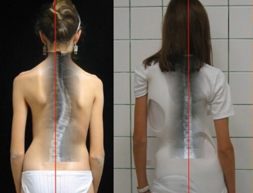 استخدام الحزام الطبي