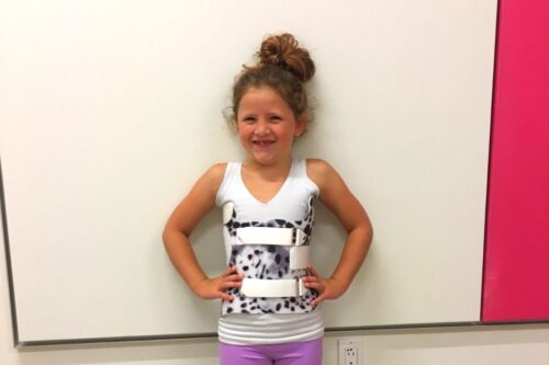 كيف يتعامل الأطفال في الواقع مع حزام اعوجاج العمود الفقري؟