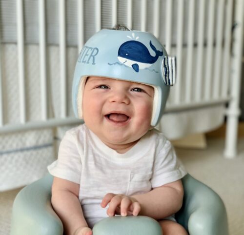 هل الخوذة ضرورية لكل طفل؟