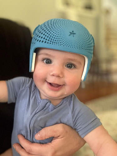 ما هي المضاعفات المحتملة لخوذة علاج تسطح الرأس؟