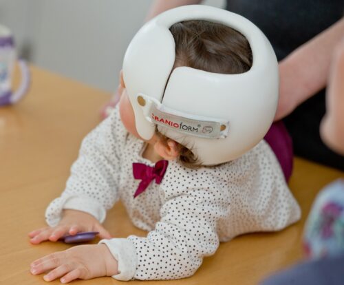 كم مدة استخدام خوذة تسطح الرأس؟