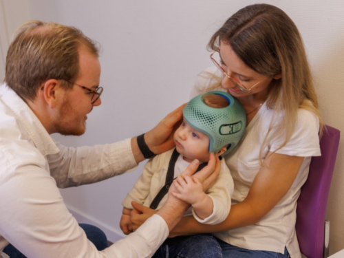 متى تكون خوذة علاج تسطح الرأس ضرورية؟