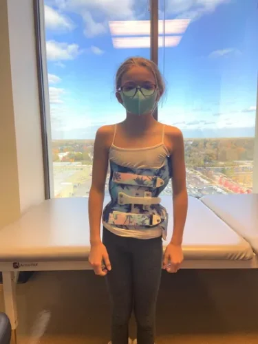 حزام اعوجاج العمود الفقري