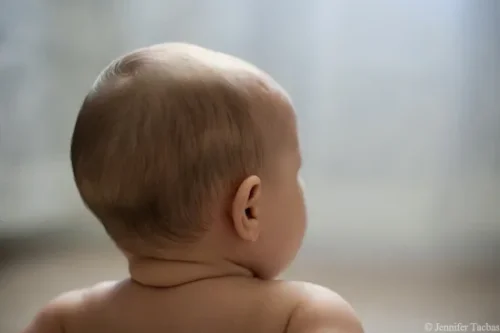 هل يعني ذلك أن عظام جمجمة الطفل تكون مغلقة تمامًا في عمر سنتين؟
